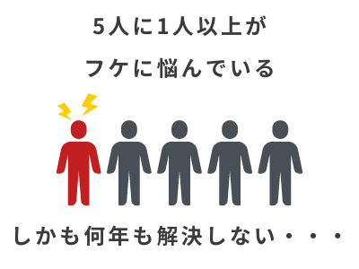 フケ 放置