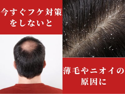 ハゲ ニオイ